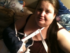 9/14/12 after surgery